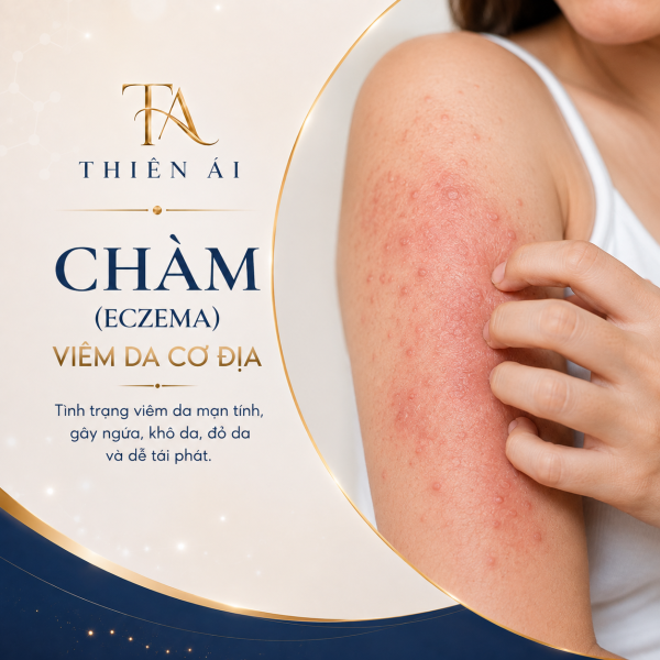 Chàm (Eczema), viêm da cơ địa Chàm (Eczema), viêm da cơ địa