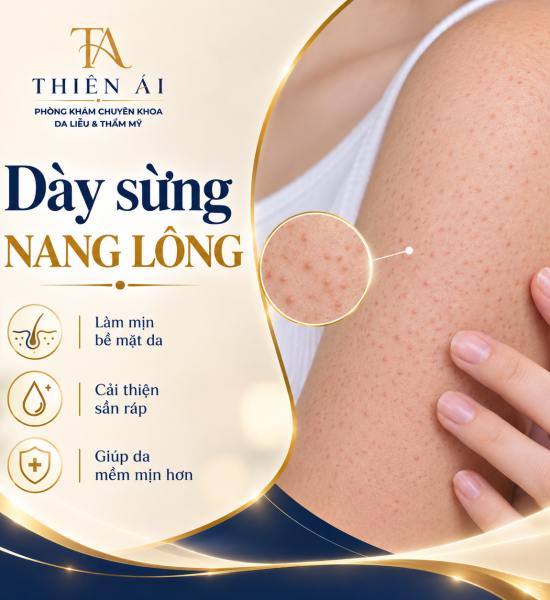 Dày sừng nang lông