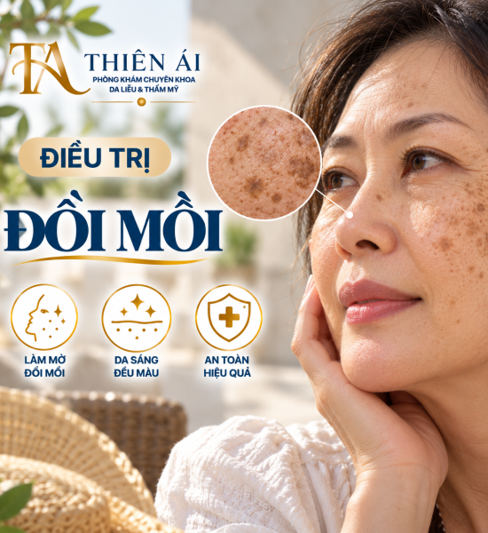 Điều trị đồi mồi
