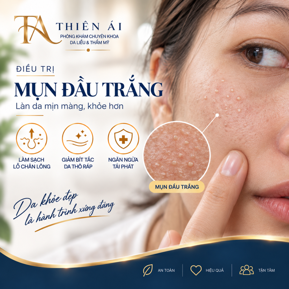 Mụn đầu trắng Mụn đầu trắng