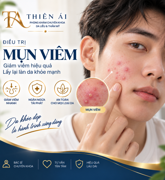 Mụn viêm