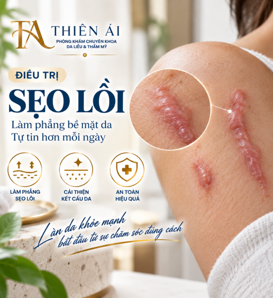 Sẹo lồi