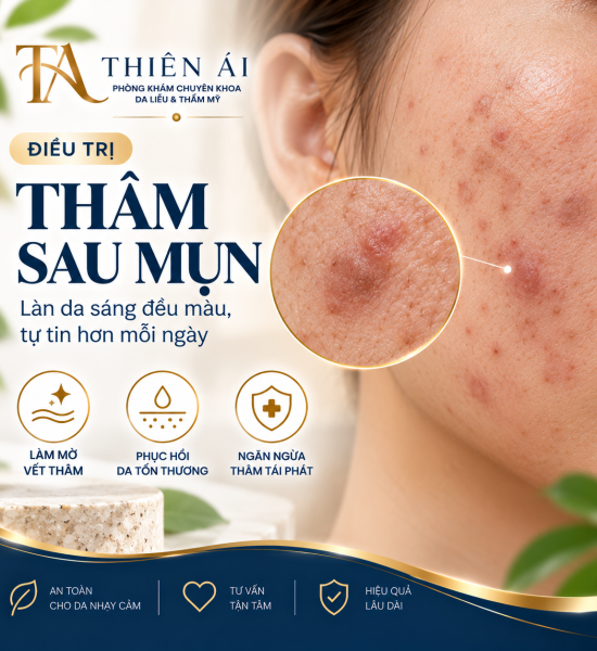 Thâm sau mụn