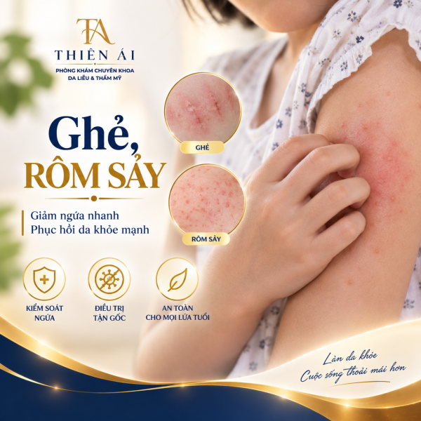 Ghẻ, rôm sảy