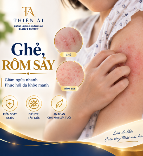 Ghẻ, rôm sảy