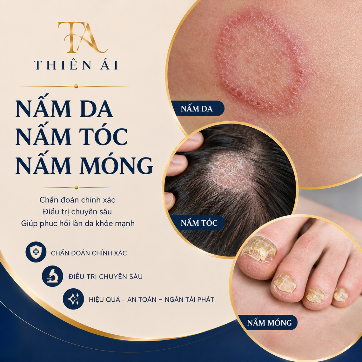 Nấm da, nấm tóc, nấm móng