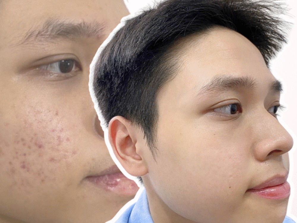 Điều trị viêm da, ngứa đỏ, nấm da