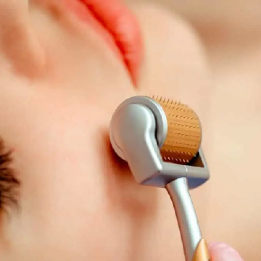  Điều trị mụn