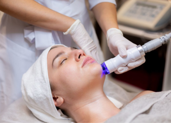 Laser Fractional – Trị Sẹo Laser Fractional – Trị Sẹo