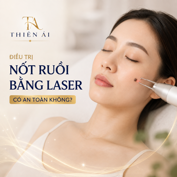 Điều trị nốt ruồi bằng Laser có an toàn không?