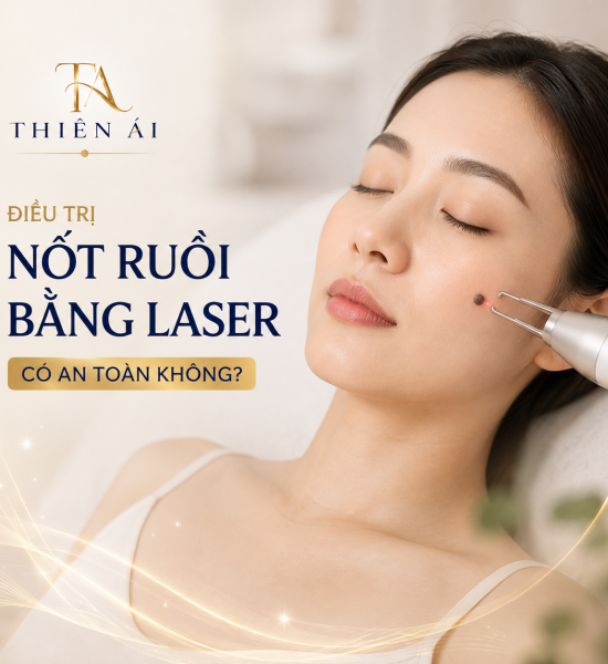 Điều trị nốt ruồi bằng Laser có an toàn không?