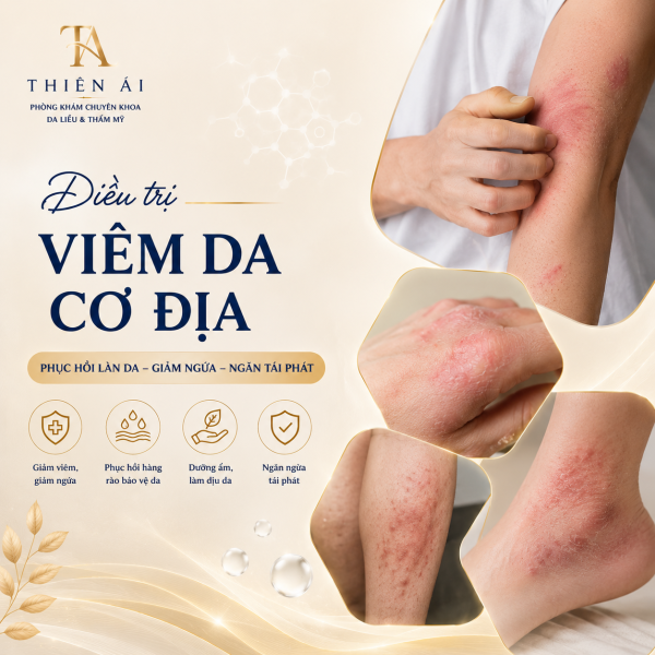 Điều trị viêm da cơ địa để kiểm soát bệnh lâu dài