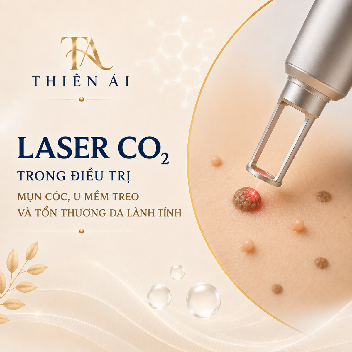 Laser CO₂ trong điều trị mụn cóc, u mềm treo và tổn thương da lành tính