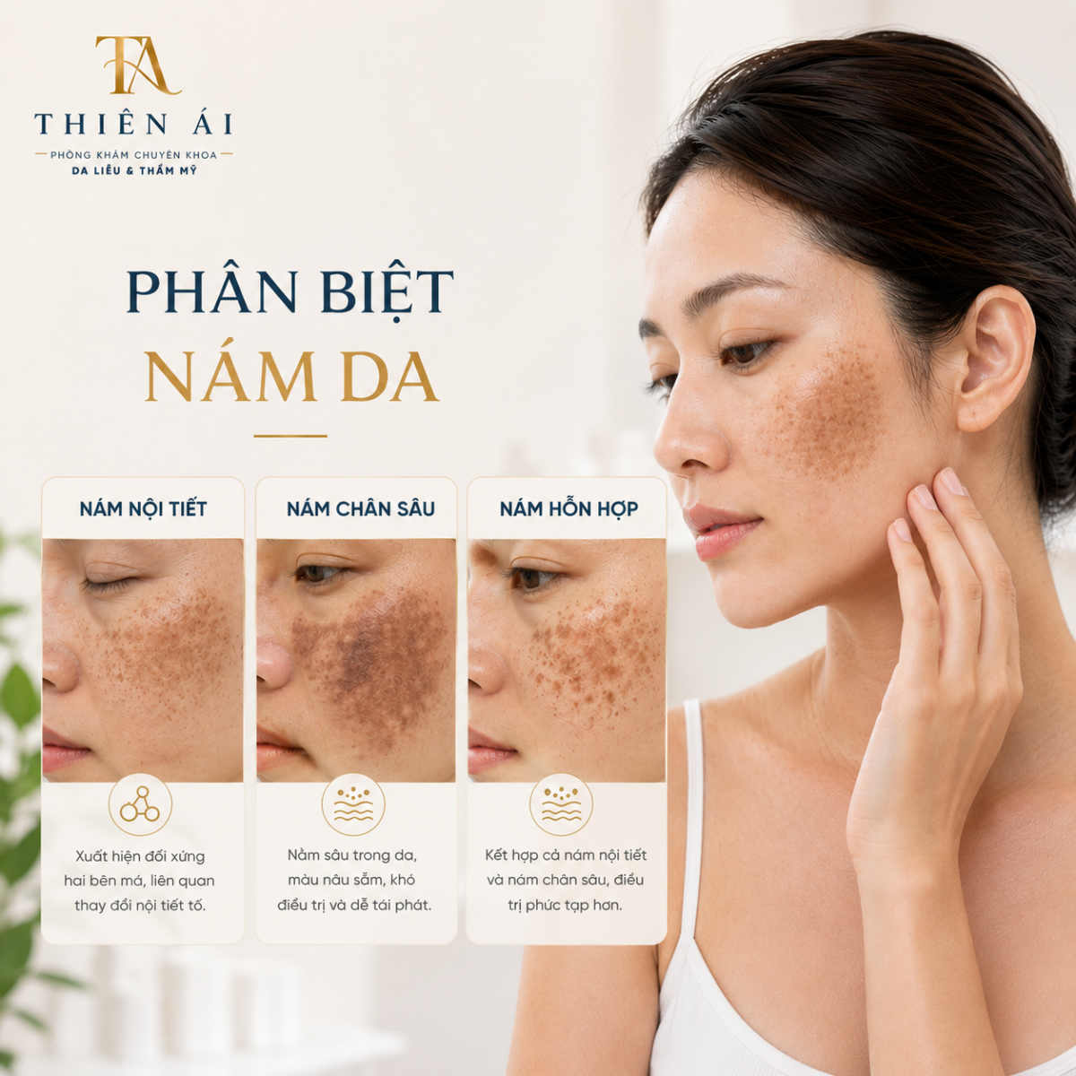 Phân biệt nám nội tiết, nám chân sâu và nám hỗn hợp